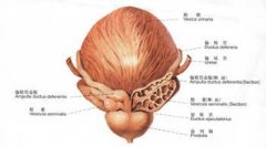 急性前列腺炎要注意哪些什么呢