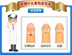 包皮过长会不会导致性病